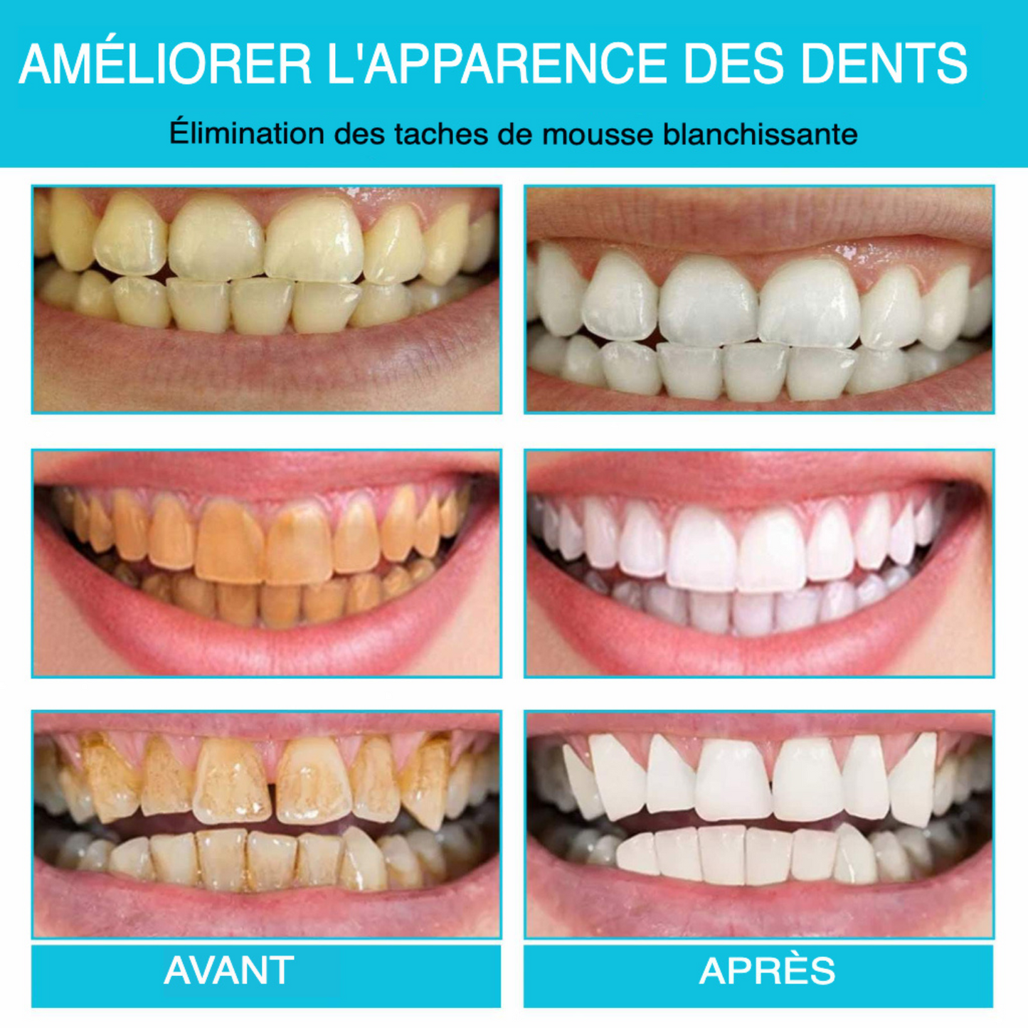 Mousse Blancheur Sourire Éclatant