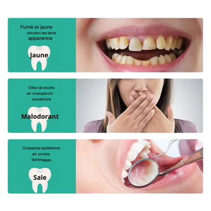 Mousse Nettoyante pour les Dents, élimine les taches de Plaque dentaire, rafraîchit l'haleine, réparation gingivale dentaire